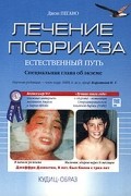 Джон Пегано - Лечение псориаза - естественный путь (сборник)