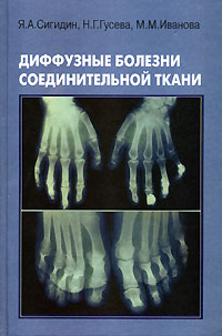  - Диффузные болезни соединительной ткани