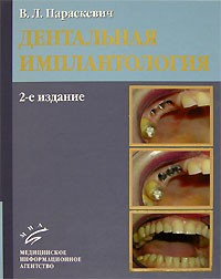 В. Л. Параскевич - Дентальная имплантология