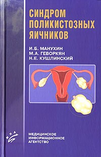  - Синдром поликистозных яичников