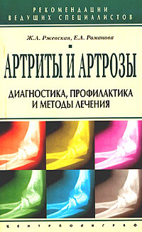  - Артриты и артрозы. Диагностика, профилактика и методы лечения