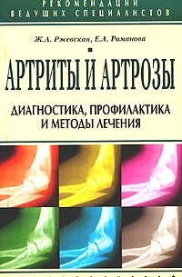  - Артриты и артрозы. Диагностика, профилактика и методы лечения