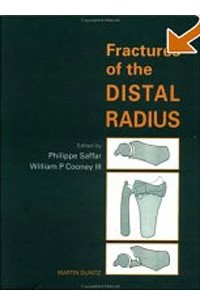 William Cooney - Fractures of the Distal Radius