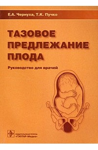 Тазовое предлежание плода