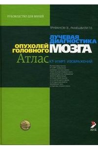  - Лучевая диагностика опухолей головного мозга. Атлас КТ- и МРТ-изображений. Руководство для врачей