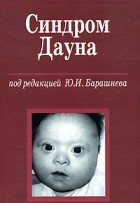 Под редакцией Ю. И. Барашнева - Синдром Дауна