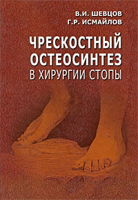  - Чрескостный остеосинтез в хирургии стопы