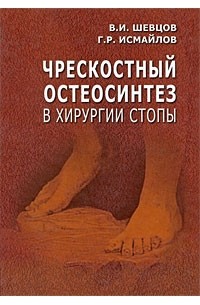  - Чрескостный остеосинтез в хирургии стопы