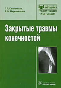  - Закрытые травмы конечностей