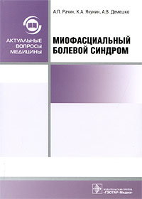  - Миофасциальный болевой синдром