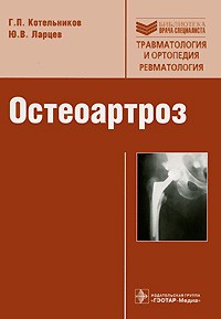  - Остеоартроз
