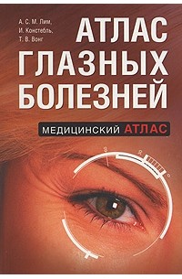 Атлас глазных болезней