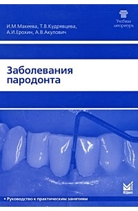  - Заболевания пародонта