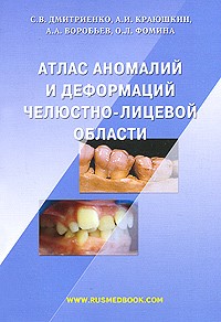  - Атлас аномалий и деформаций челюстно-лицевой области
