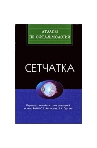 Сетчатка