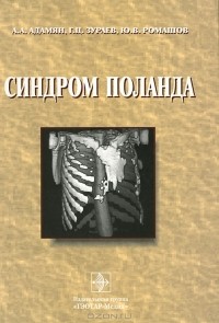  - Синдром Поланда