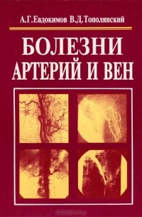  - Болезни артерий и вен