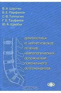  - Диагностика и хирургическое лечение неврологических осложнений поясничного остеохондроза