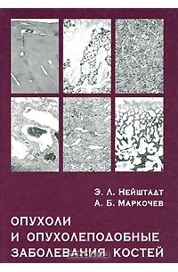  - Опухоли и опухолеподобные заболевания костей