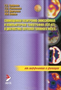 - Совмещенная позитронно-эмиссионная и компьютерная томография (ПЭТ-КТ) в диагностике опухолей головного мозга