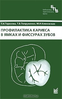  - Профилактика кариеса в ямках и фиссурах зубов