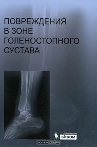 Сергей Миронов - Повреждения в зоне голеностопного сустава (+ CD-ROM)
