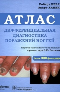  - Дифференциальная диагностика поражения ногтей. Атлас