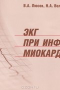  - ЭКГ при инфаркте миокарда (+ ЭКГ-линейка)