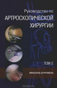 Михаэль Штробель - Руководство по артроскопической хирургии. В 2 томах. Том 2