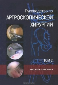 Михаэль Штробель - Руководство артроскопической хирургии. В 2 томах. Том 2