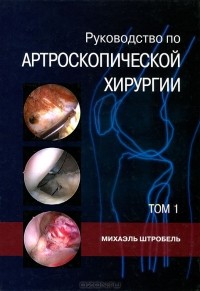 Михаэль Штробель - Руководство по артроскопической хирургии. В 2 томах. Том 1