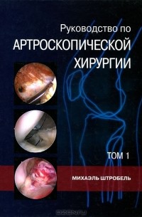 Михаэль Штробель - Руководство по артроскопической хирургии. В 2 томах. Том 1