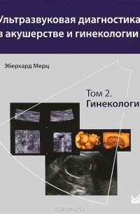 Эберхард Мерц - Ультразвуковая диагностика в акушерстве и гинекологии. В 2 томах. Том 2. Гинекология