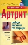 Павел Евдокименко - Артрит. Свобода движений без операций