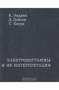  - Электронограммы и их интерпретация