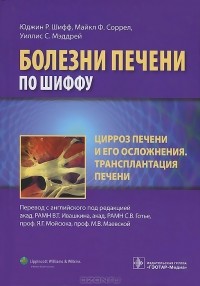  - Цирроз печени и его осложнения. Трансплантация печени