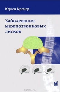 Юрген Кремер - Заболевания межпозвонковых дисков