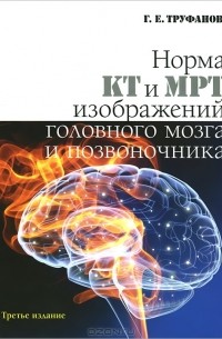 Геннадий Труфанов - Норма КТ и МРТ изображений головного мозга и позвоночника