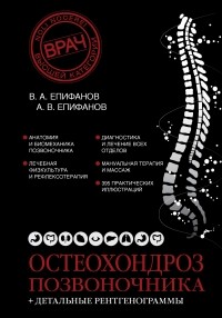 Епифанов В.А. - Остеохондроз позвоночника + детальные рентгенограммы