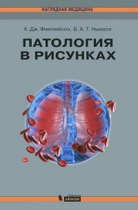 Патология в рисунках