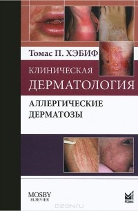 Томас Хэбиф - Клиническая дерматология. Аллергические дерматозы