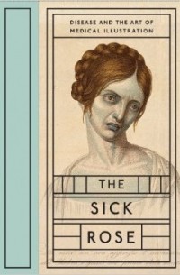 The Sick Rose