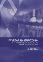 Наталья Серова - Лучевая диагностика в стоматологической имплантологии