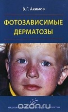 Всеволод Акимов - Фотозависимые дерматозы