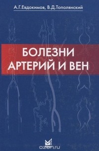  - Болезни артерий и вен