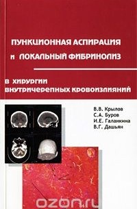 Пункционная аспирация и локальный фибринолиз в хирургии внутричерепных кровоизлияний