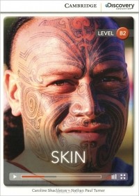  - Skin: Level B2