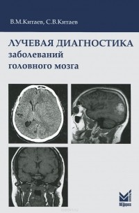  - Лучевая диагностика заболеваний головного мозга