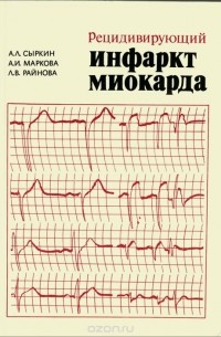 Специалисты опубликовали руководство, как заниматься сексом после инфаркта или с кардиостимулятором