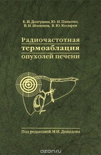  - Радиочастотная термоаблация опухолей печени